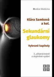 Sekundární glaukomy - Vybrané kapitoly